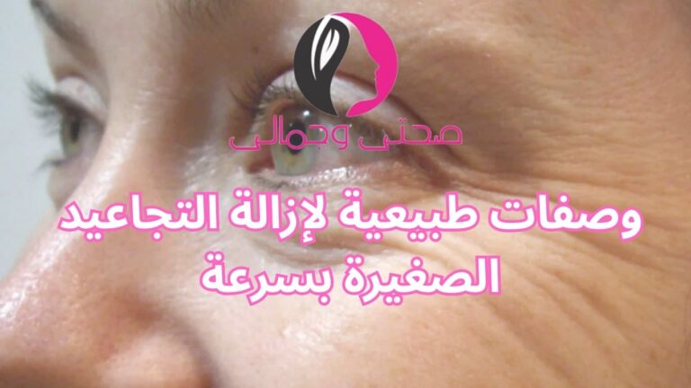 وصفات طبيعية لإزالة التجاعيد الصغيرة بسرعة