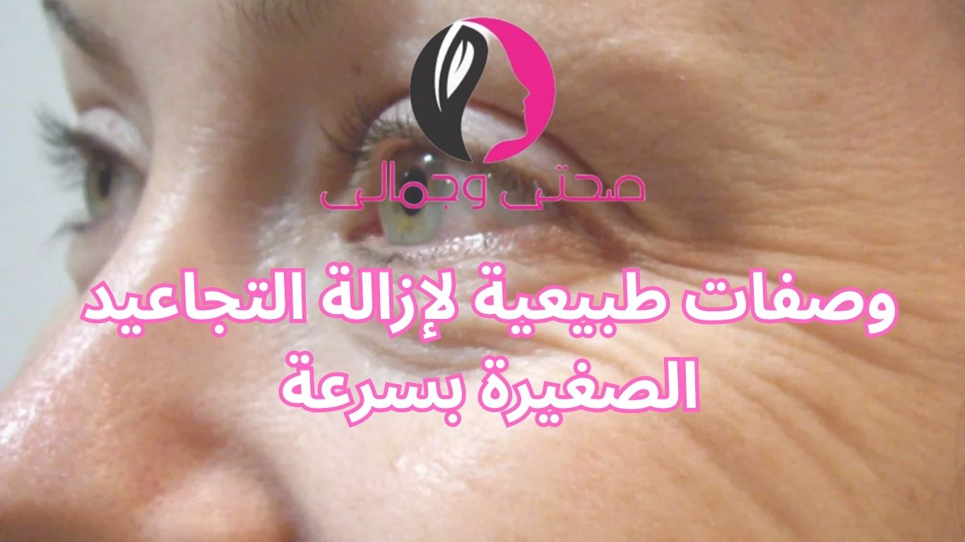 وصفات طبيعية لإزالة التجاعيد الصغيرة بسرعة