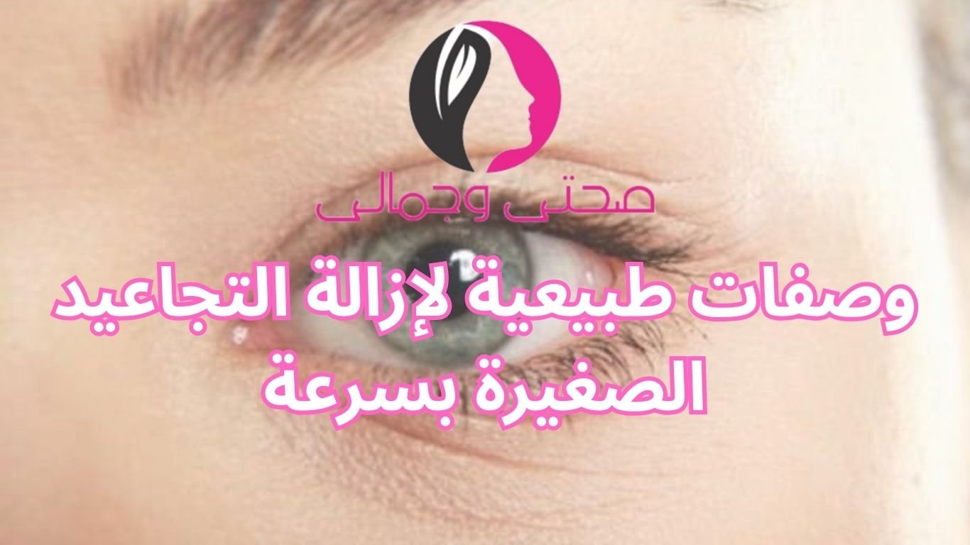 وصفات طبيعية لإزالة التجاعيد الصغيرة بسرعة