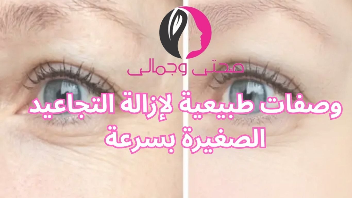 وصفات طبيعية لإزالة التجاعيد الصغيرة بسرعة