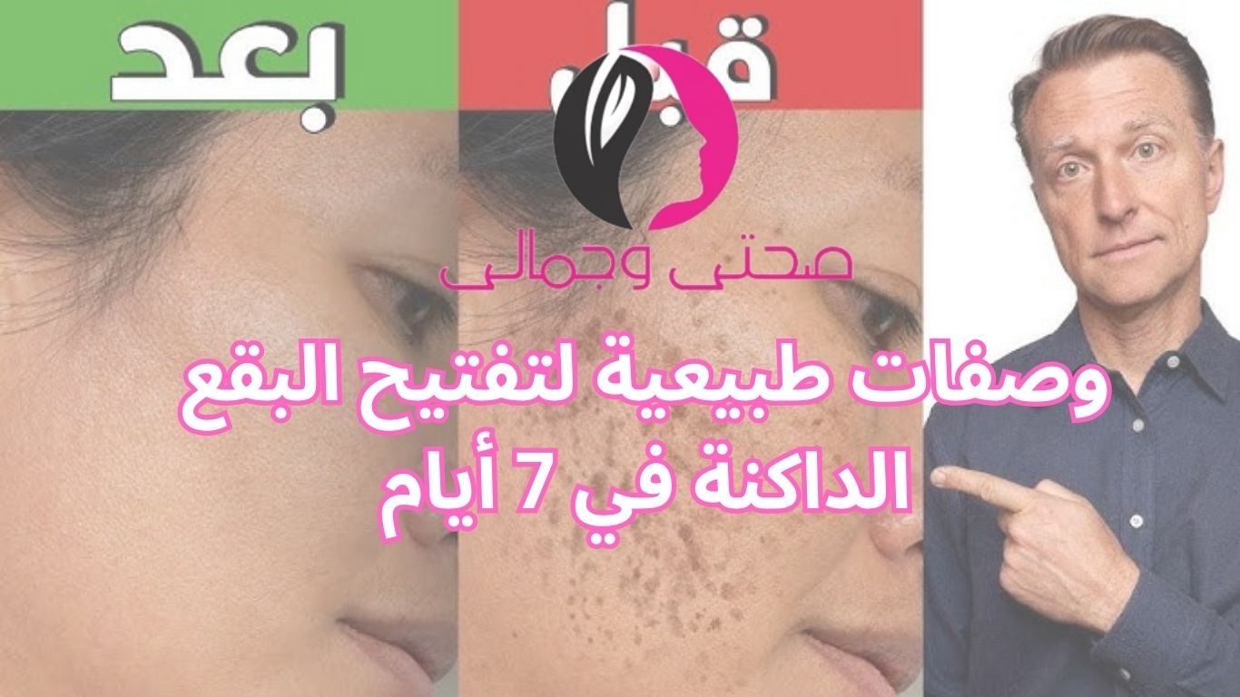 وصفات طبيعية لتفتيح البقع الداكنة في 7 أيام