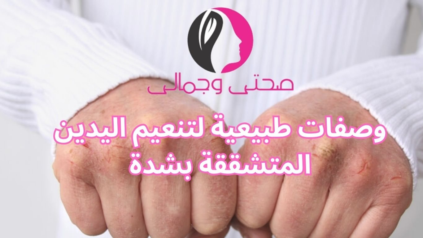 وصفات طبيعية لتنعيم اليدين المتشققة بشدة