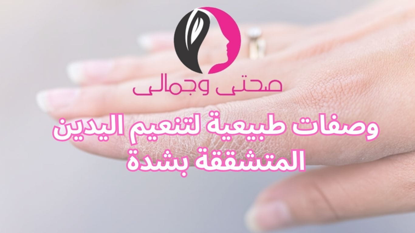 وصفات طبيعية لتنعيم اليدين المتشققة بشدة