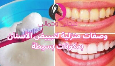 وصفات منزلية لتبييض الأسنان بمكونات بسيطة