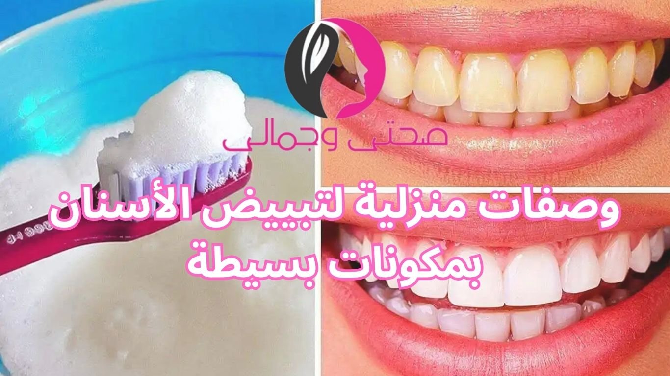 وصفات منزلية لتبييض الأسنان بمكونات بسيطة