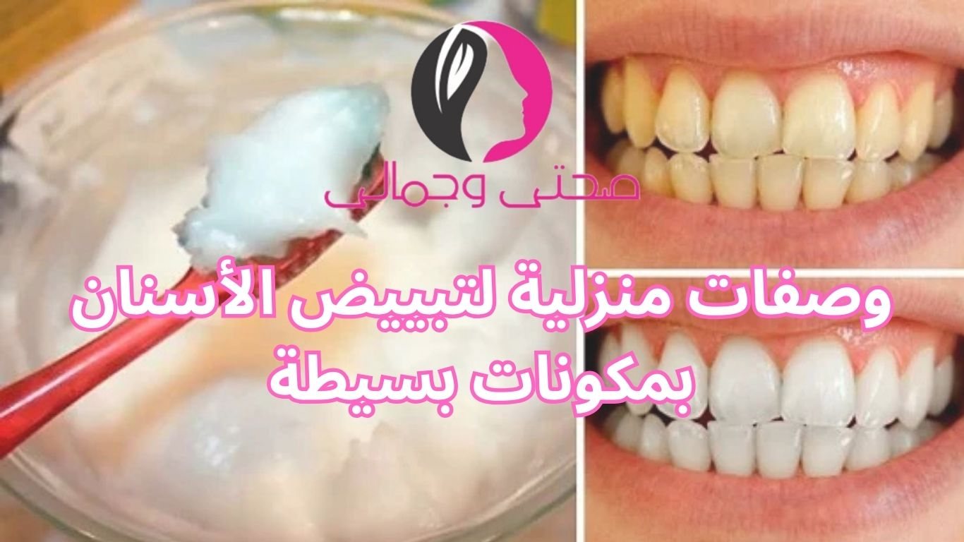 وصفات منزلية لتبييض الأسنان بمكونات بسيطة