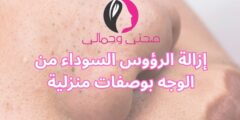 إزالة الرؤوس السوداء من الوجه بوصفات منزلية