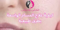 كيفية علاج المسام الواسعة بطرق طبيعية
