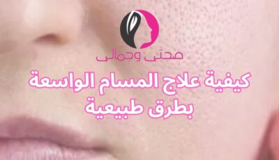 كيفية علاج المسام الواسعة بطرق طبيعية