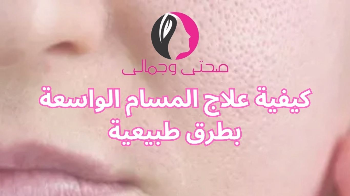 كيفية علاج المسام الواسعة بطرق طبيعية
