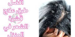 أفضل طرق علاج قشرة الشعر في المنزل