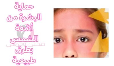 حماية البشرة من أشعة الشمس بطرق طبيعية