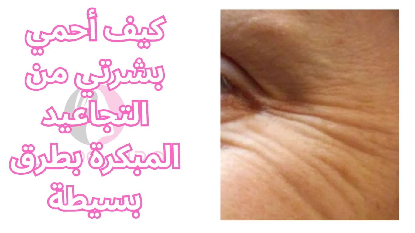 كيف أحمي بشرتي من التجاعيد المبكرة بطرق بسيطة