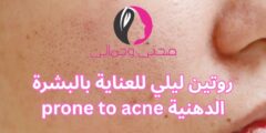 روتين ليلي للعناية بالبشرة الدهنية prone to acne