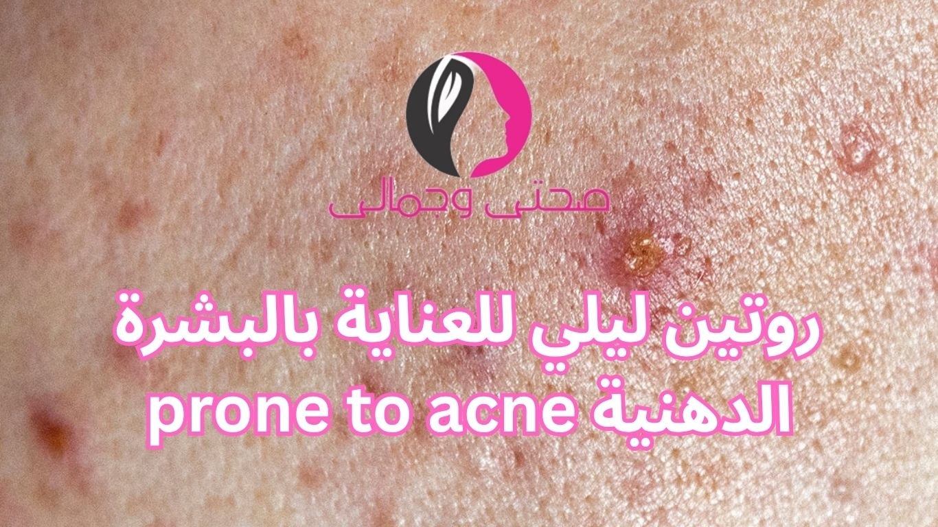 روتين ليلي للعناية بالبشرة الدهنية prone to acne