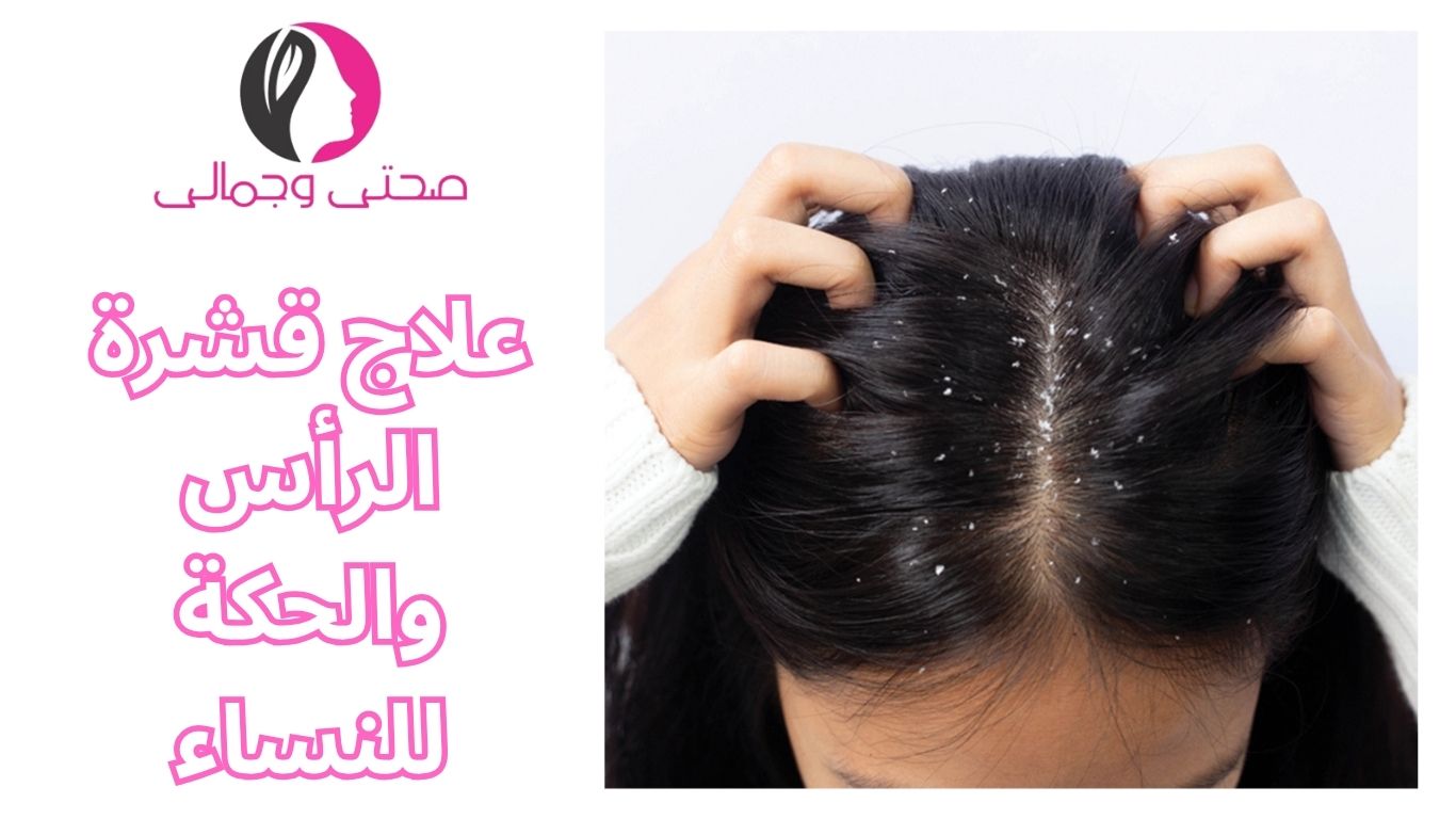 علاج قشرة الرأس والحكة للنساء