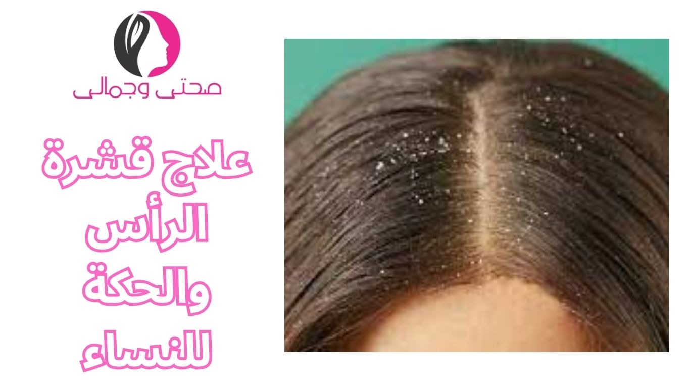 علاج قشرة الرأس والحكة للنساء