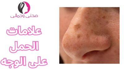 علامات الحمل على الوجه