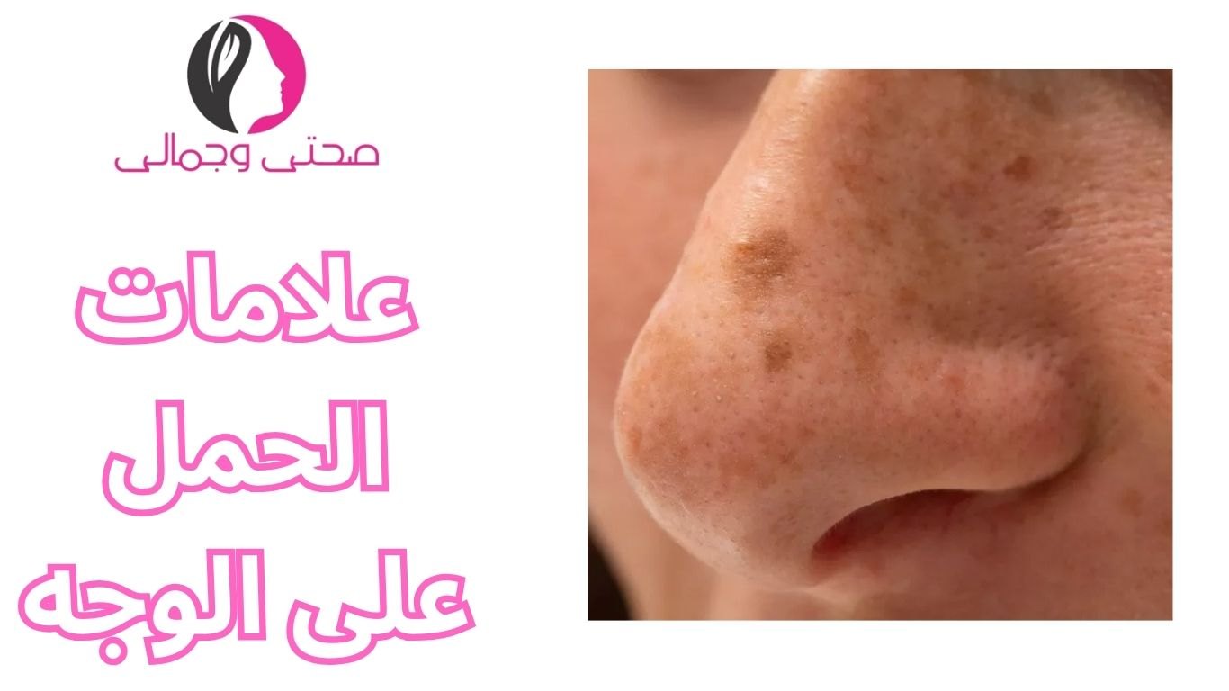 علامات الحمل على الوجه