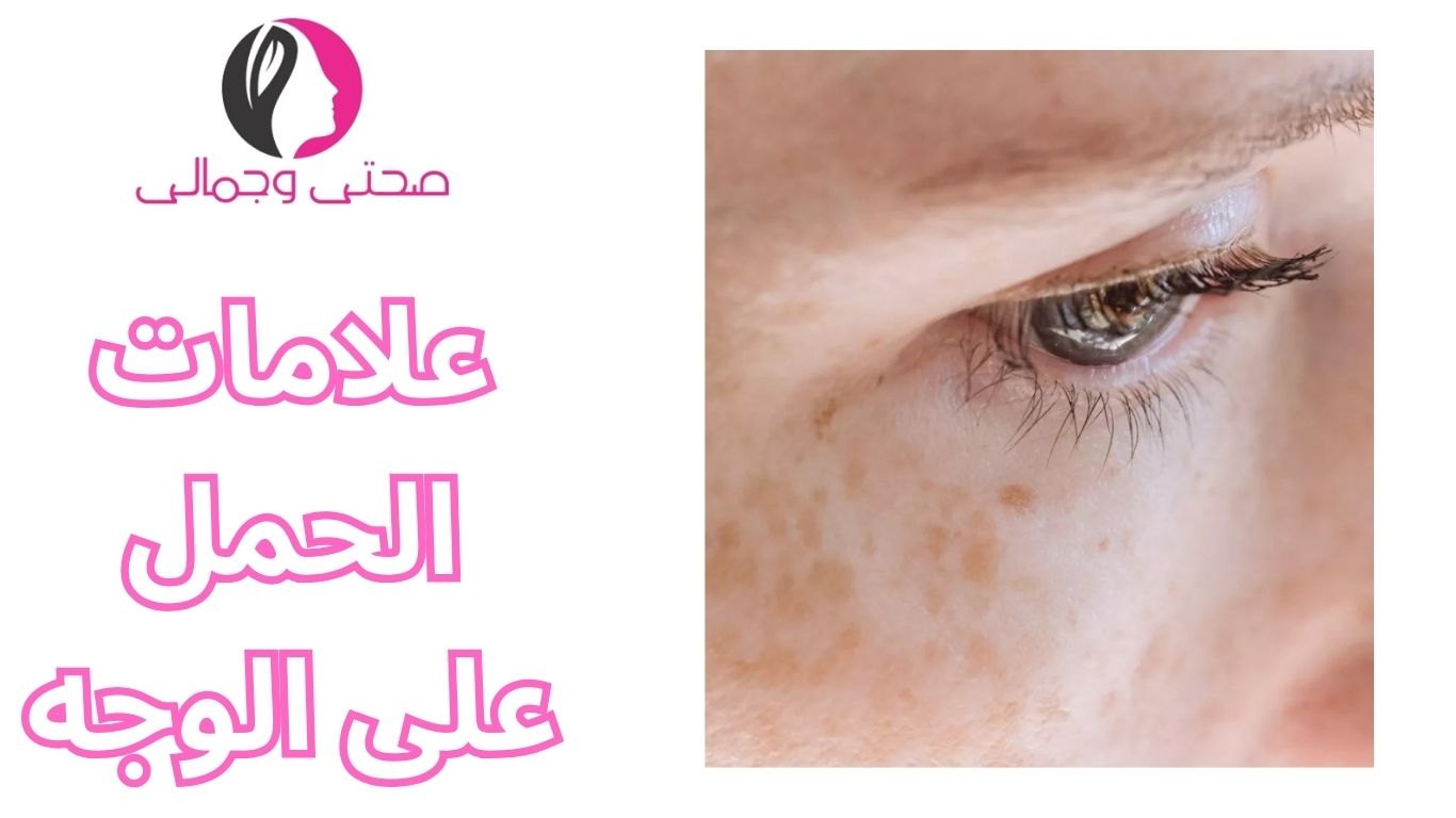 علامات الحمل على الوجه