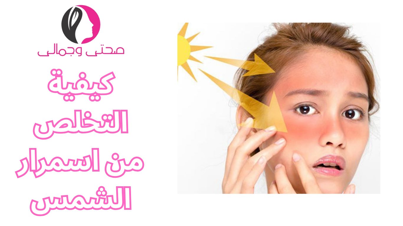 كيفية التخلص من اسمرار الشمس