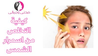 كيفية التخلص من اسمرار الشمس
