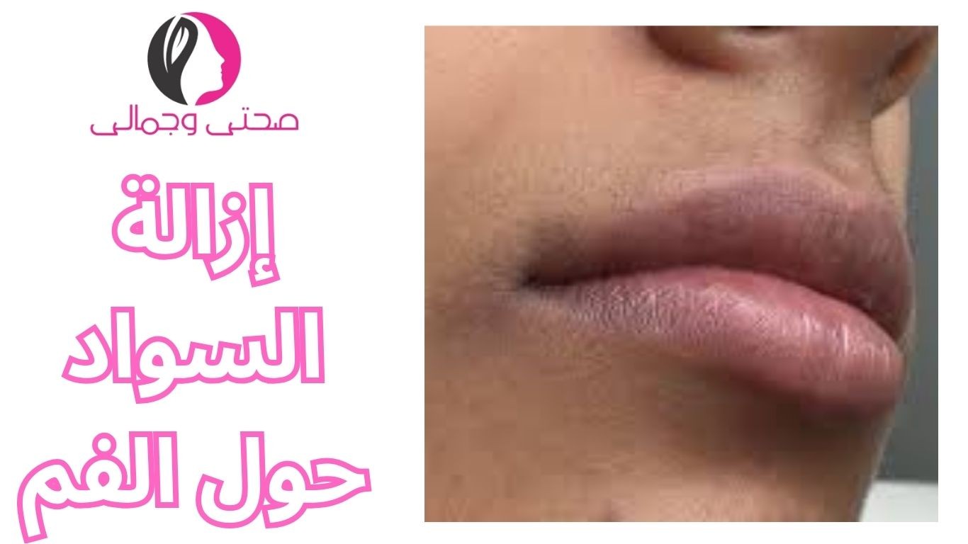 إزالة السواد حول الفم