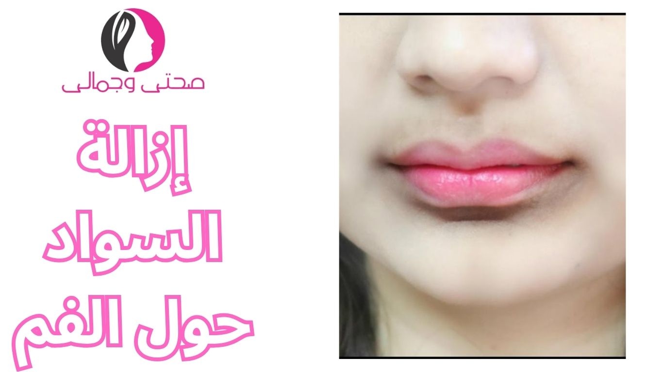 إزالة السواد حول الفم