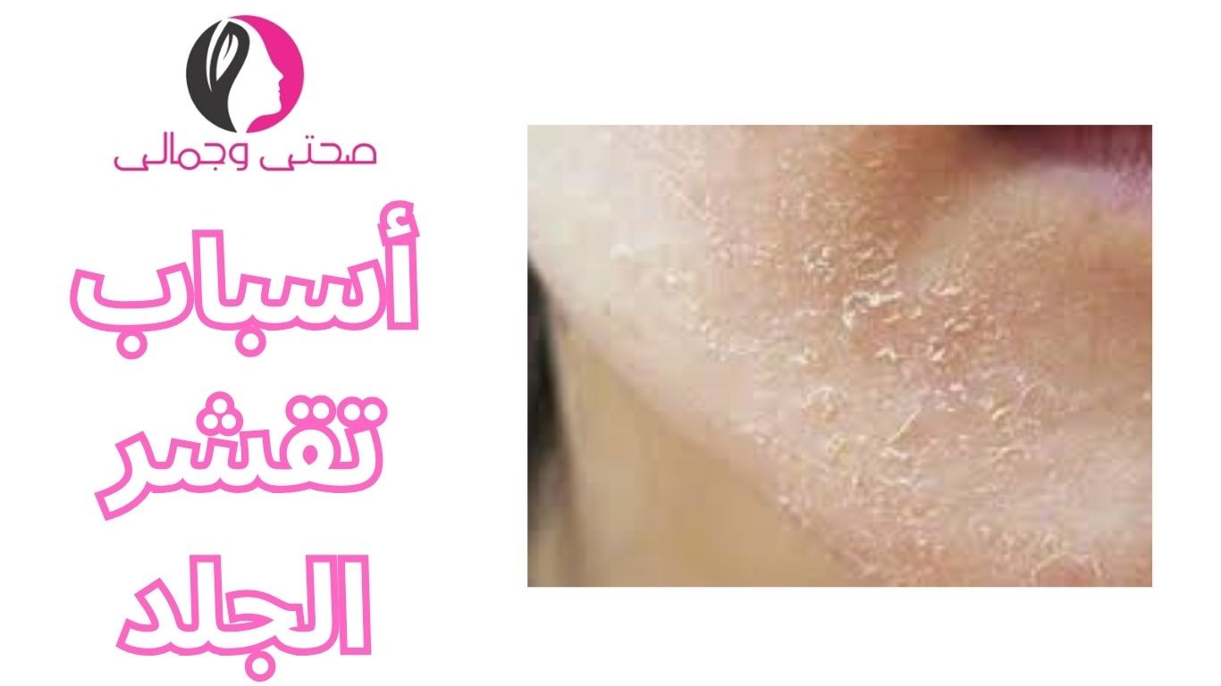 أسباب تقشر الجلد