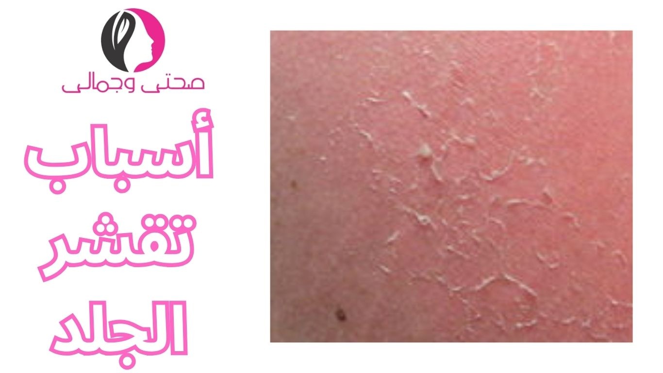 أسباب تقشر الجلد