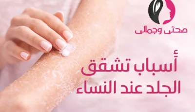 أسباب تشقق الجلد عند النساء