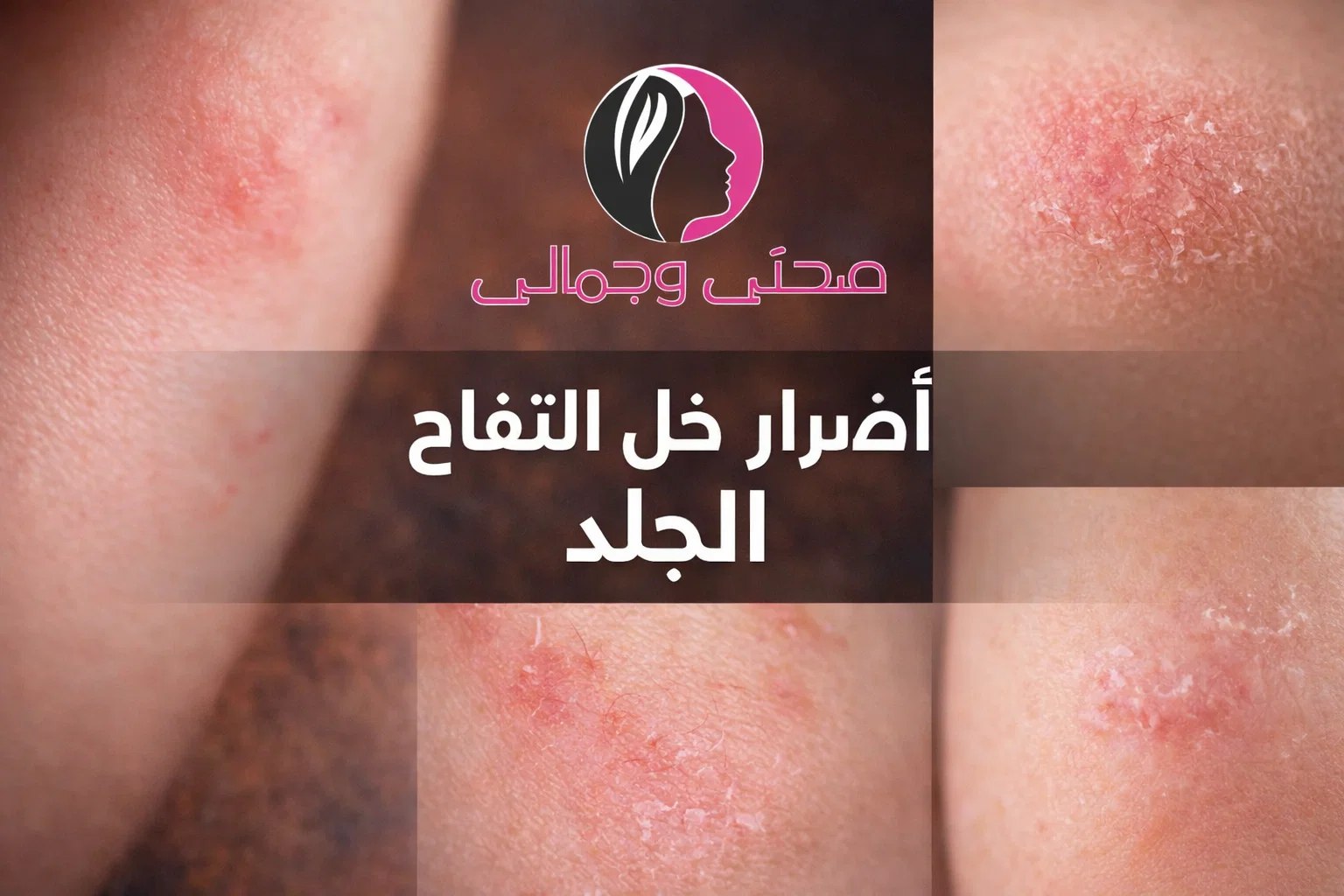 أضرار خل التفاح على الجلد