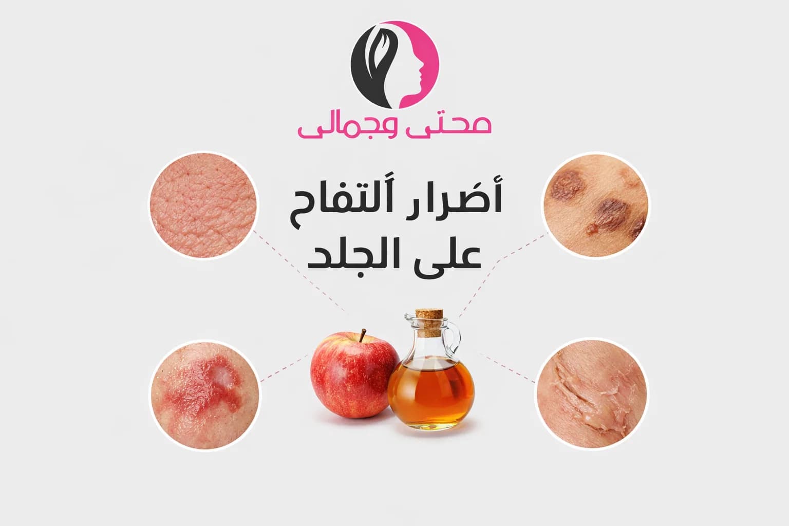 أضرار خل التفاح على الجلد