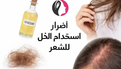أضرار استخدام الخل للشعر