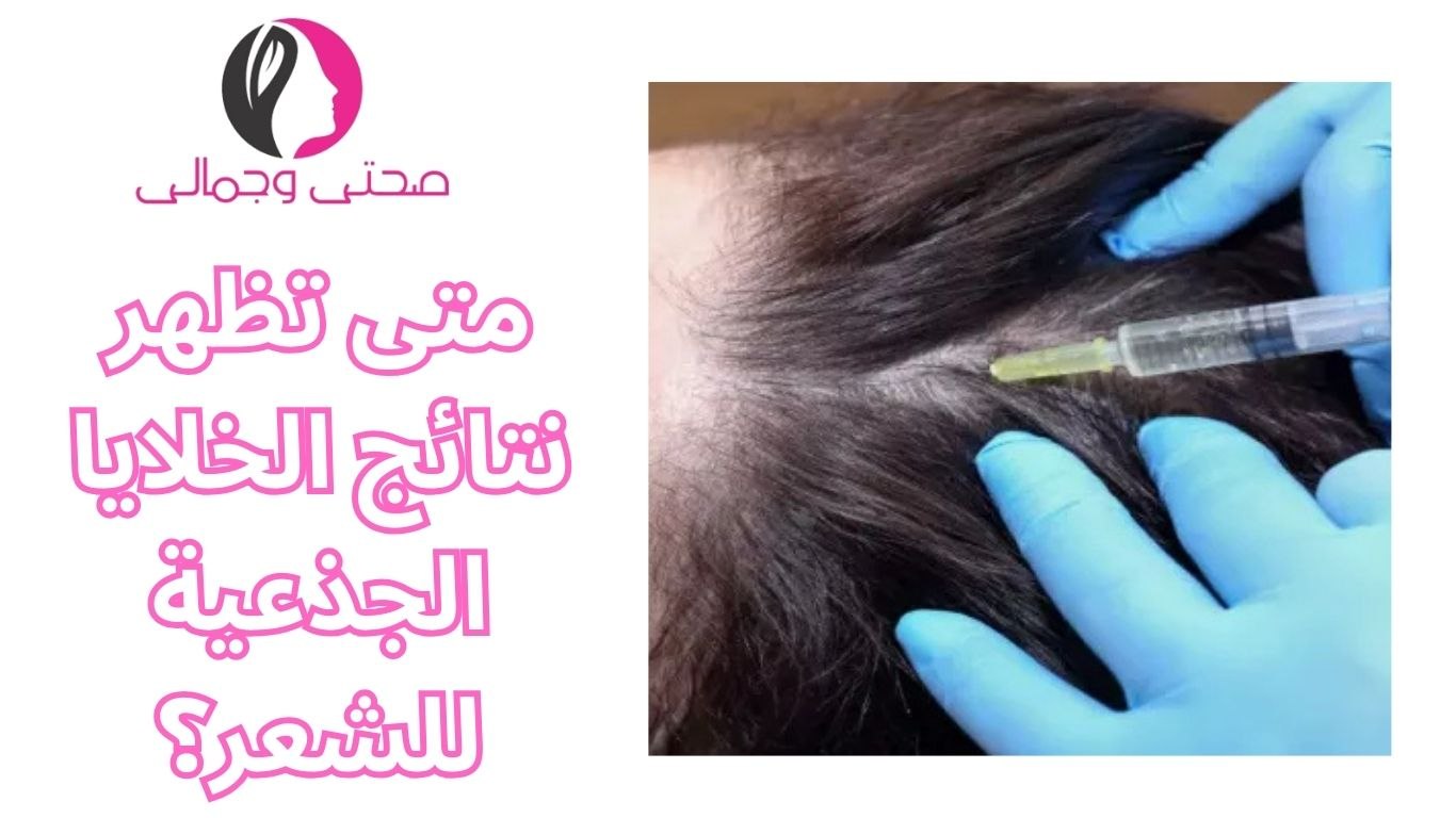 متى تظهر نتائج الخلايا الجذعية للشعر؟
