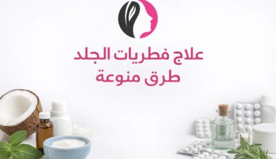 علاج فطريات الجلد: طرق متنوعة