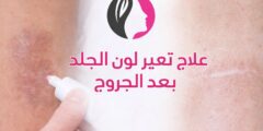 علاج تغير لون الجلد بعد الجروح