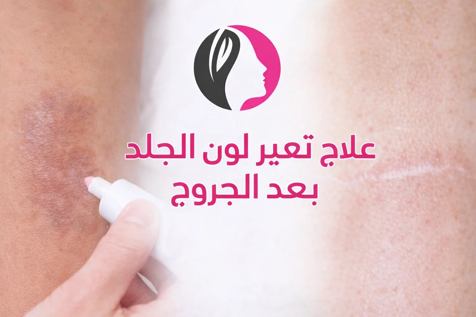 علاج تغير لون الجلد بعد الجروح