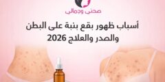 أسباب ظهور بقع بنية على البطن والصدر والعلاج 2026