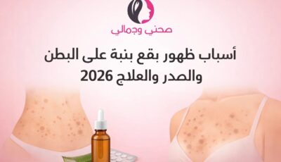 أسباب ظهور بقع بنية على البطن والصدر والعلاج 2026