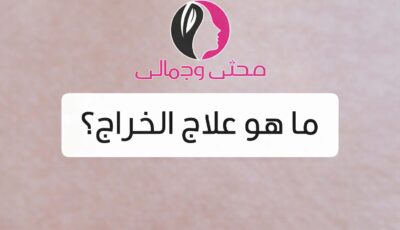 ما هو علاج الخُراج؟