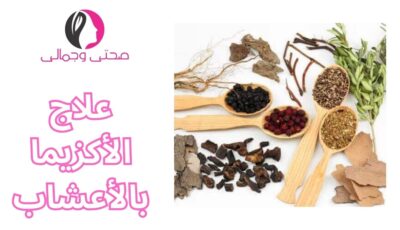 علاج الأكزيما بالأعشاب
