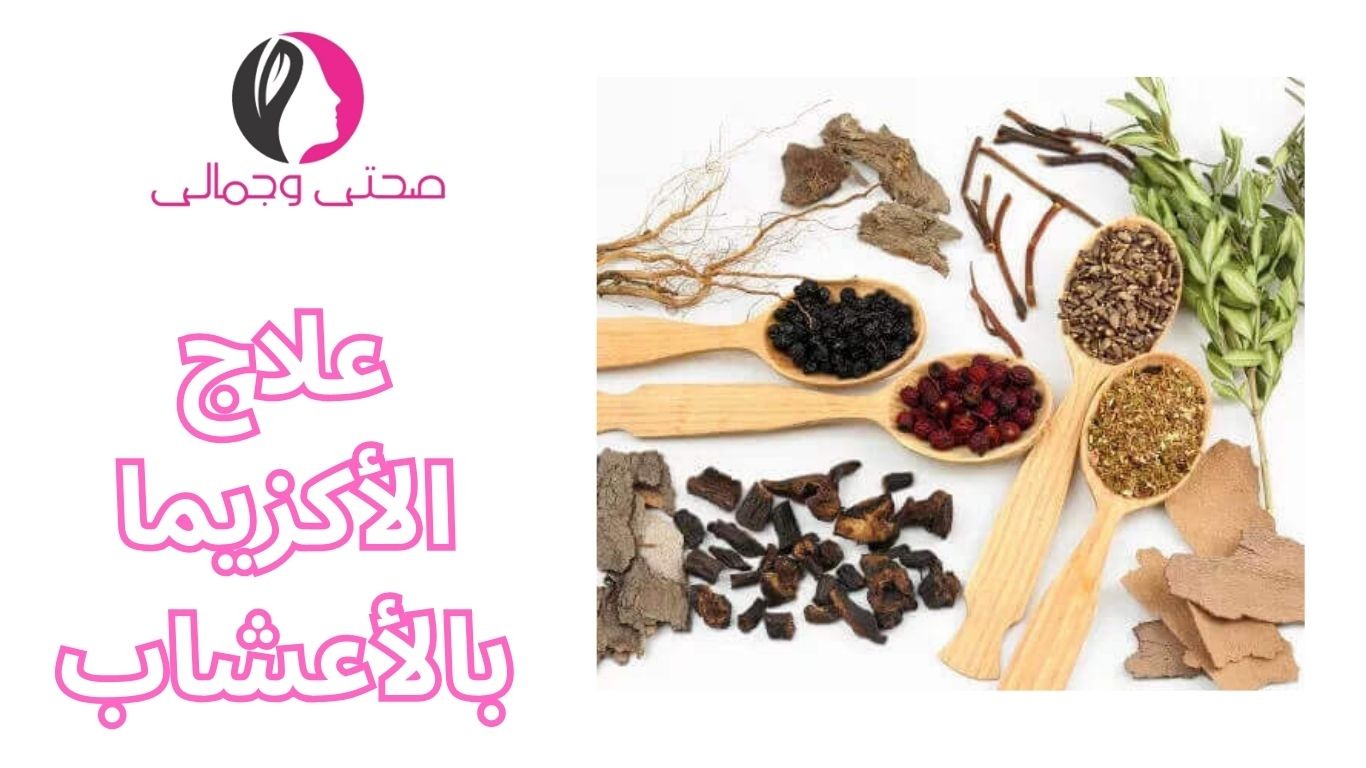 علاج الأكزيما بالأعشاب