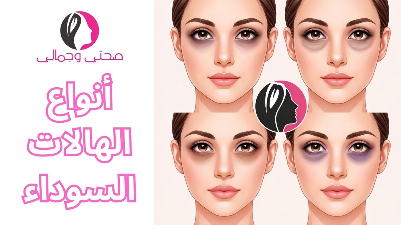 أنواع الهالات السوداء