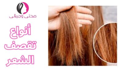 أنواع تقصف الشعر