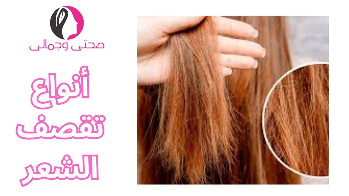 أنواع تقصف الشعر