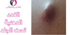 الغدد الدهنية تحت الجلد