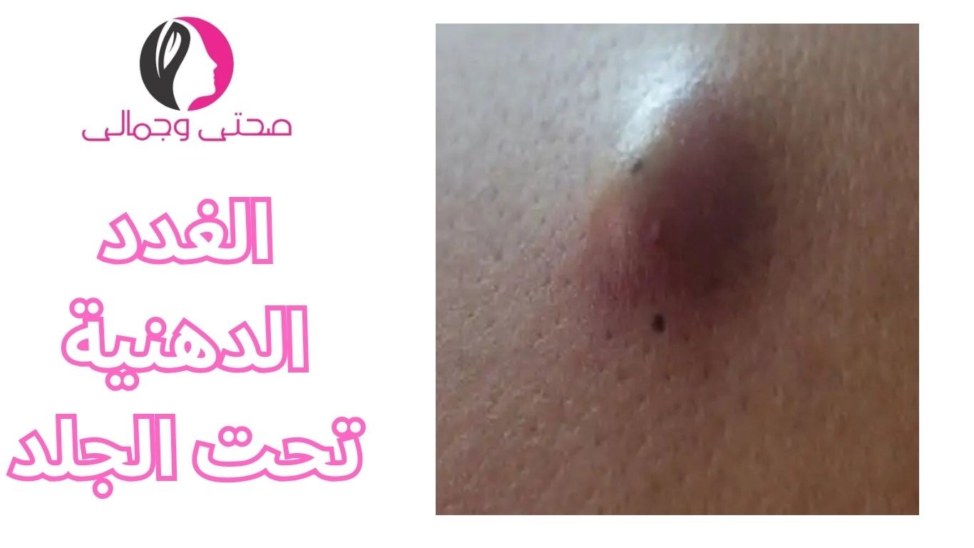 الغدد الدهنية تحت الجلد