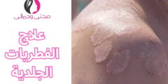 علاج الفطريات الجلدية
