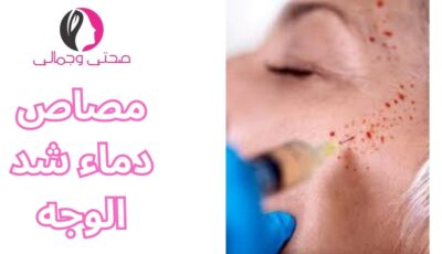 مصاص دماء شد الوجه